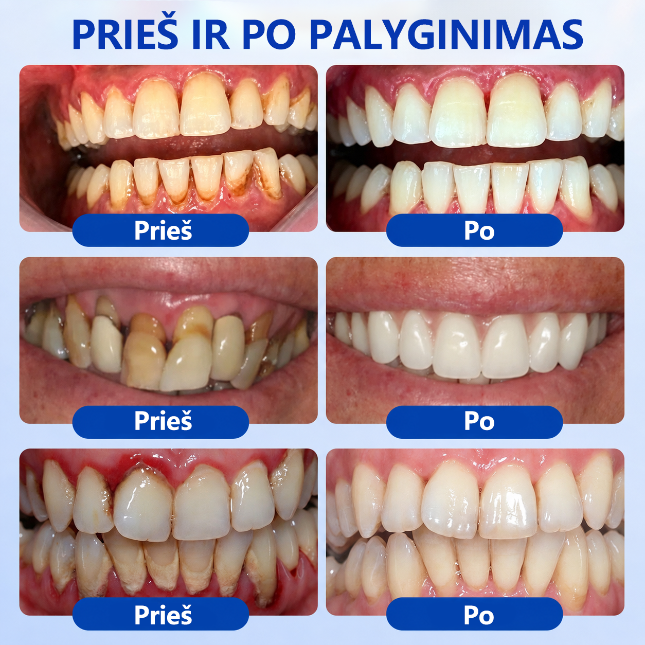 𝐄𝐯𝐨𝐥𝐯𝐢𝐨𝐧® 𝐆𝐮𝐦𝐑𝐞𝐯𝐢𝐯𝐞 𝐏𝐞𝐫𝐢𝐨𝐝𝐨𝐧𝐭𝐨 𝐫𝐞𝐠𝐞𝐧𝐞𝐫𝐚𝐜𝐢𝐣𝐨𝐬 𝐠𝐞𝐥𝐢𝐬⚡