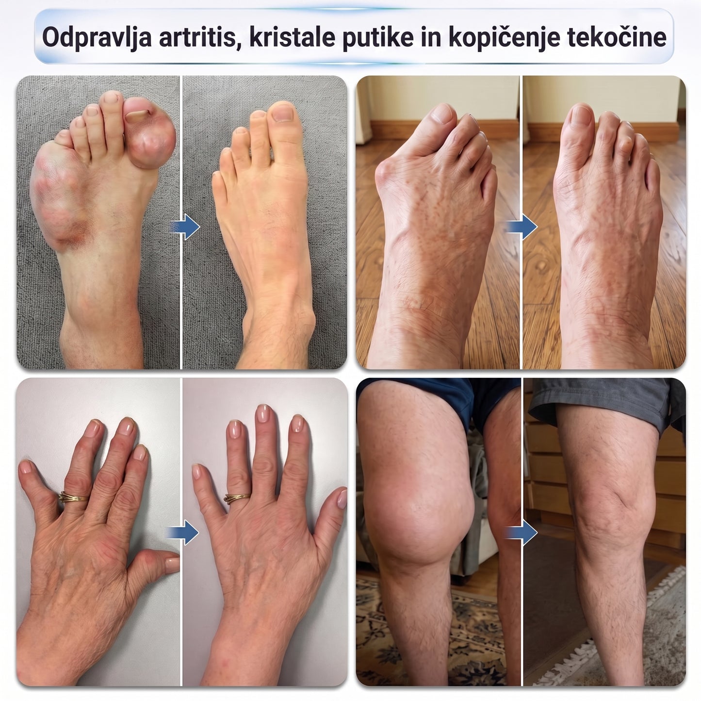 𝐎𝐅𝐈𝐂𝐈𝐀𝐋𝐈 𝐏𝐀𝐑𝐃𝐔𝐎𝐓𝐔𝐕Ė | 𝐈𝐅𝐌𝐀𝐆𝐈𝐂® 𝟎,𝟎𝟓 𝐦𝐦 𝐌𝐢𝐤𝐫𝐨𝐚𝐝𝐚𝐭𝐢𝐧𝐢𝐬 𝐆𝐫𝐞𝐢𝐭𝐨 𝐏𝐨𝐯𝐞𝐢𝐤𝐢𝐨 𝐒ą𝐧𝐚𝐫𝐢ų 𝐢𝐫 𝐊𝐚𝐮𝐥ų 𝐒𝐤𝐚𝐮𝐬𝐦ą 𝐌𝐚𝐥š𝐢𝐧𝐚𝐧𝐭𝐢𝐬 𝐑𝐮𝐭𝐮𝐥𝐢𝐧𝐢𝐬 𝐀𝐩𝐥𝐢𝐤𝐚𝐭𝐨𝐫𝐢𝐮𝐬🎃