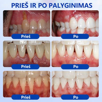 𝐄𝐯𝐨𝐥𝐯𝐢𝐨𝐧® 𝐆𝐮𝐦𝐑𝐞𝐯𝐢𝐯𝐞 𝐏𝐞𝐫𝐢𝐨𝐝𝐨𝐧𝐭𝐨 𝐫𝐞𝐠𝐞𝐧𝐞𝐫𝐚𝐜𝐢𝐣𝐨𝐬 𝐠𝐞𝐥𝐢𝐬⚡
